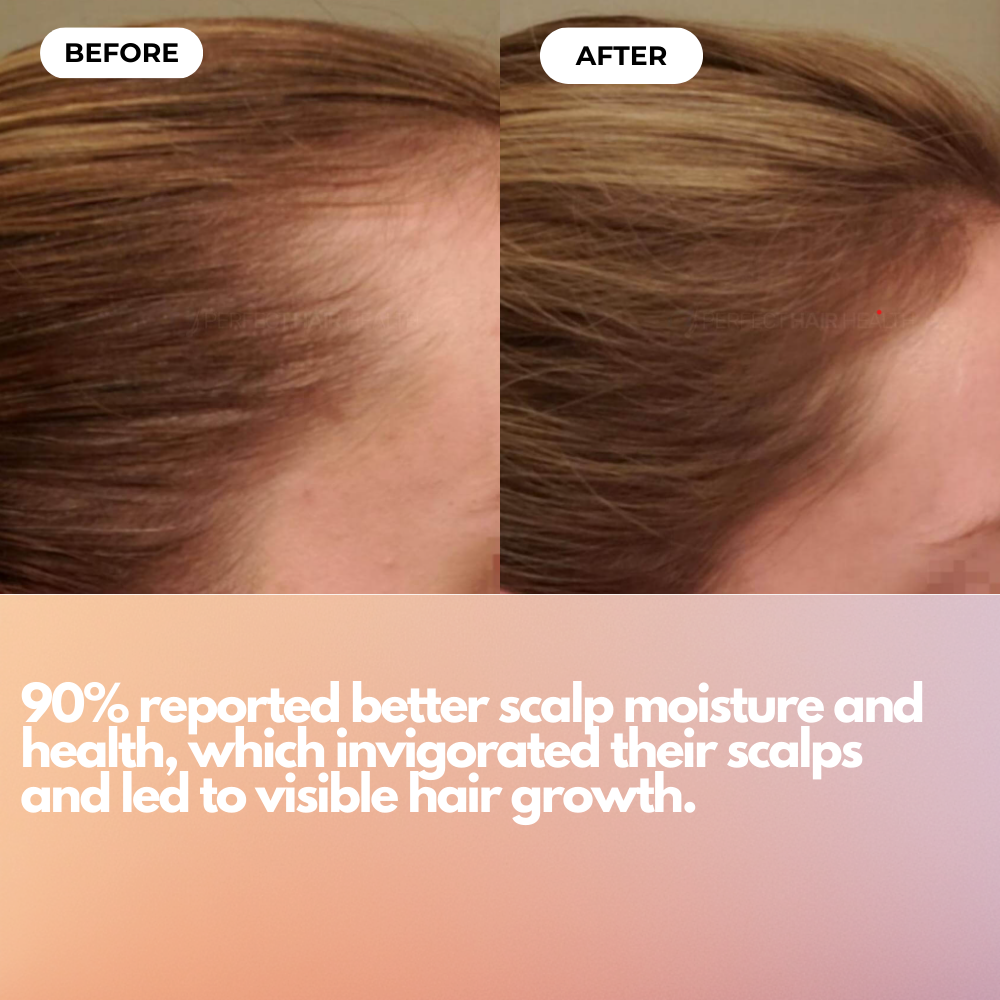 Scalp Massager for Hair Growth