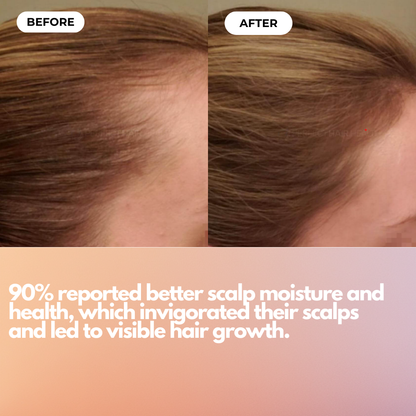Scalp Massager for Hair Growth
