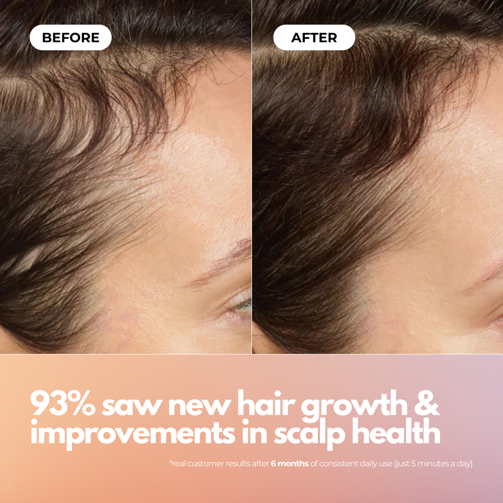 Red Light Therapy Scalp Massage Brush