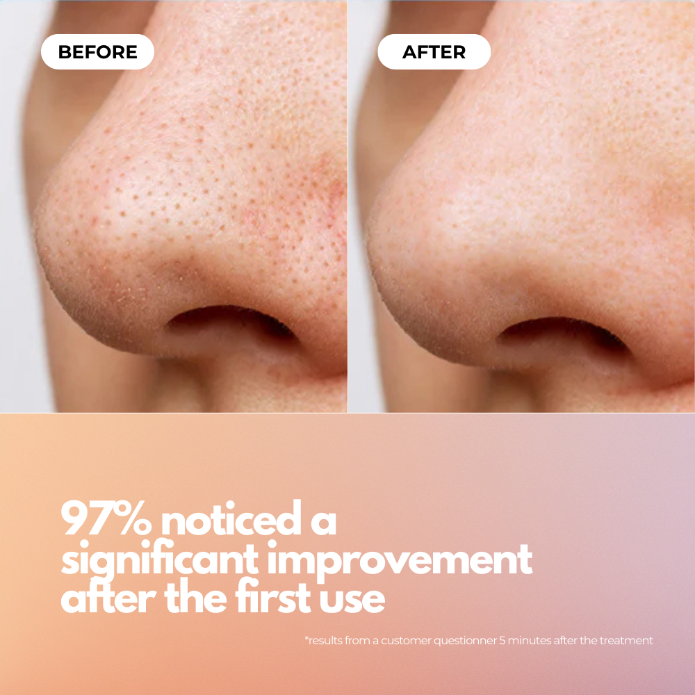Ultrasonic Skin Scrubber
